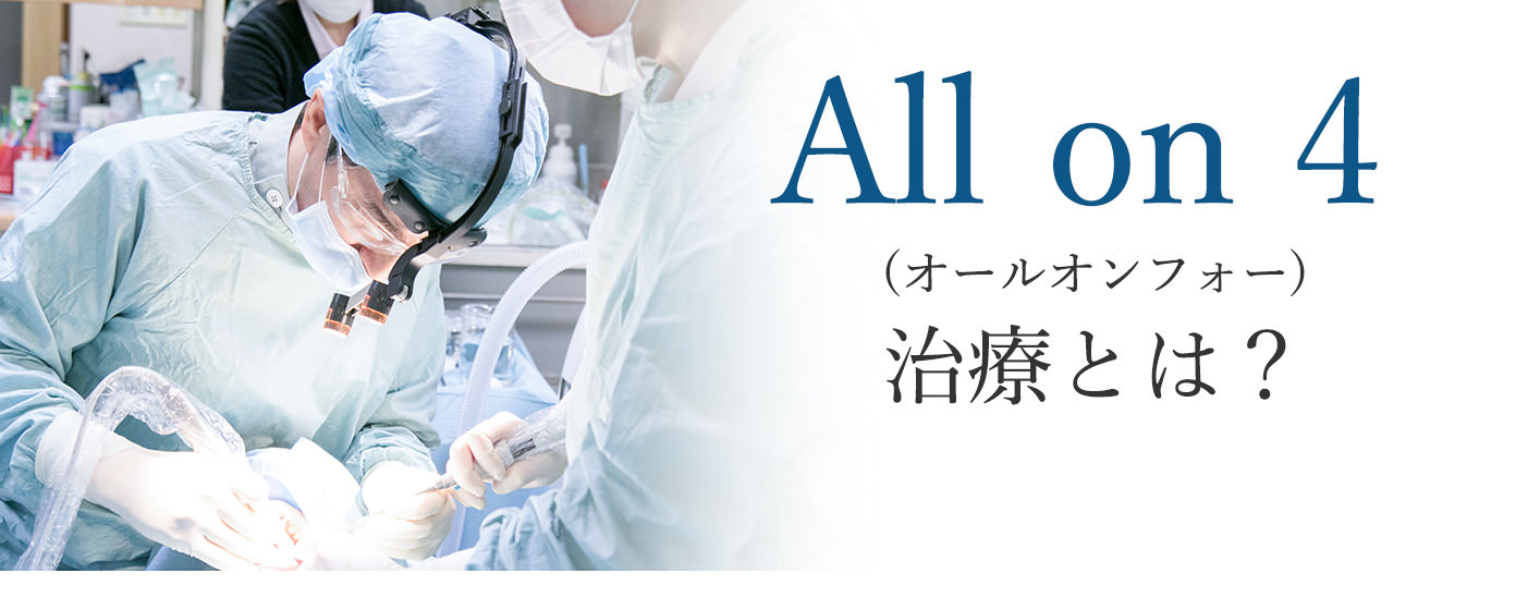 (オールオンフォー)治療とは?
