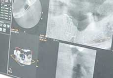 口の内の検査とレントゲン検査
