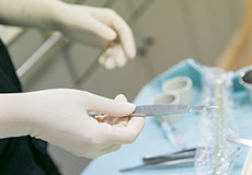 インプラントの診断と治療計画