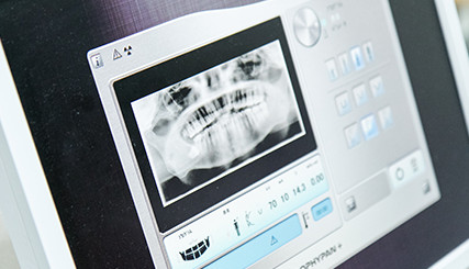 当院で使用している歯科用CT